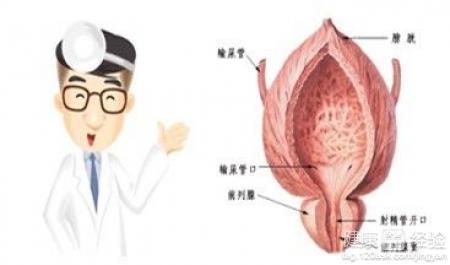 前列腺炎的治療方法與策略，前列腺炎的治療方法與策略詳解